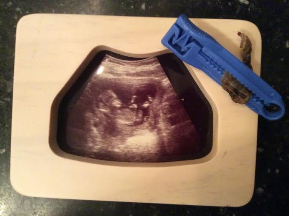 spreekbeurt-zwanger-bevalling-bevruchting-geboorte-albertine-trotse-moeders-navelstreng-echo